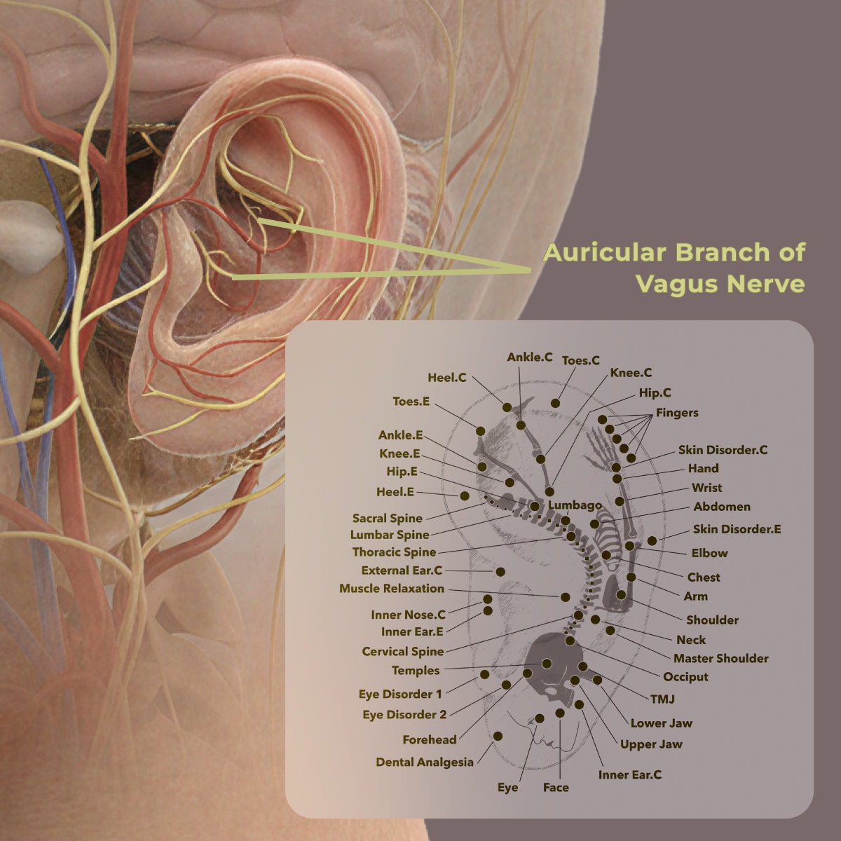 When two worlds of human care meet: How ancient ear acupuncture and modern neuroscience amazingly converge