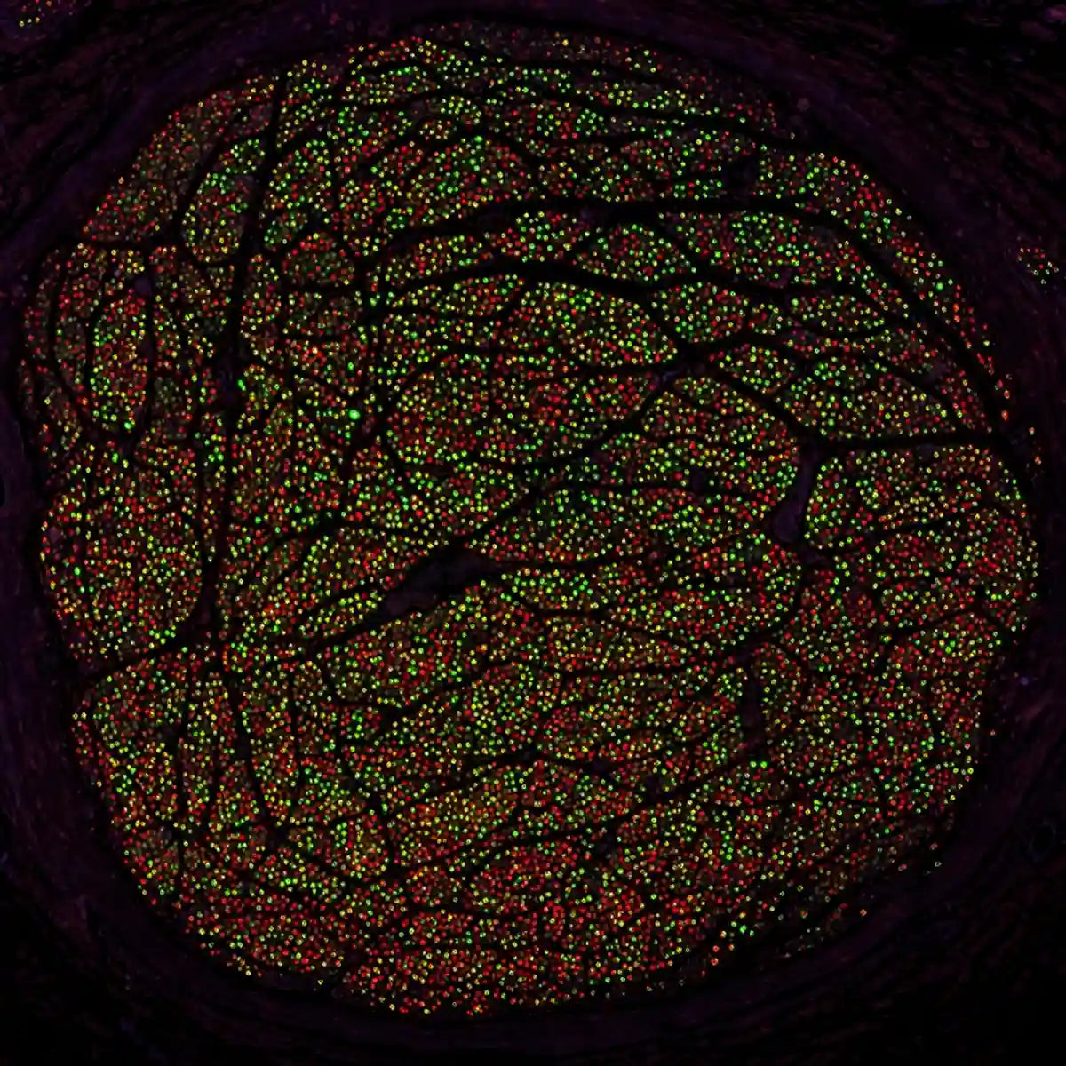 Vagus Nerve Atlas: The World's First Comprehensive Human Map for Precision Neuromodulation