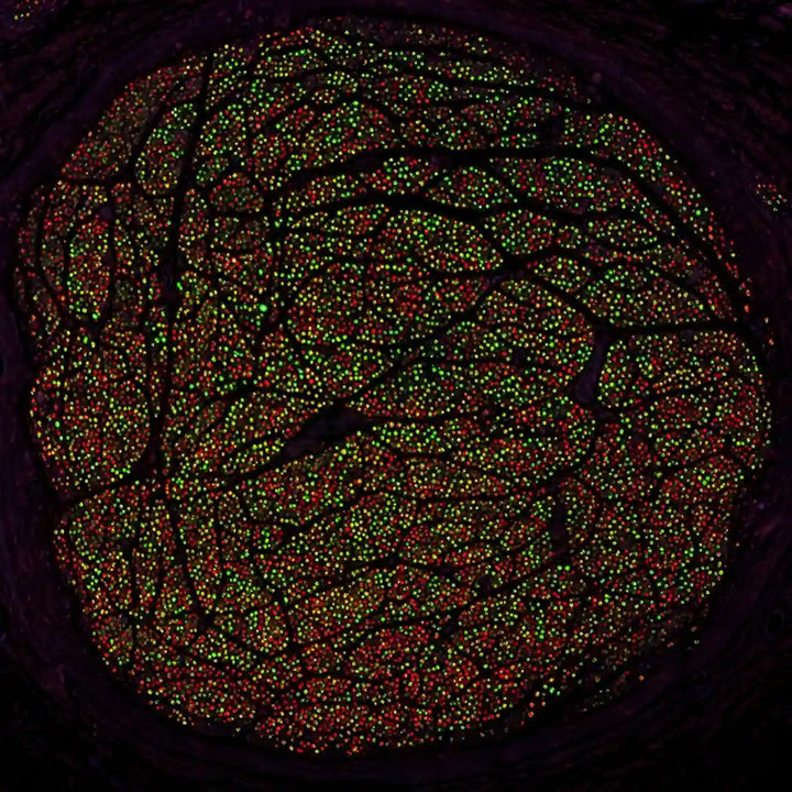 Vagus Nerve Atlas: The World's First Comprehensive Human Map for Precision Neuromodulation