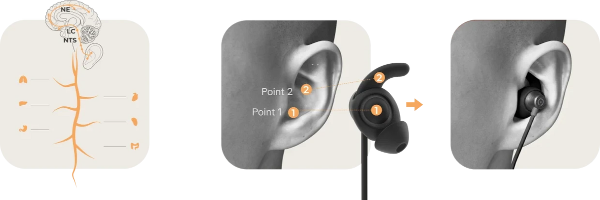 Diagrama de colocación del auricular Vita